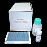 チオレドキシンELISA Kit（ELISA Kit for human thioredoxin) 